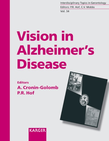 Vision in Alzheimer’s Disease