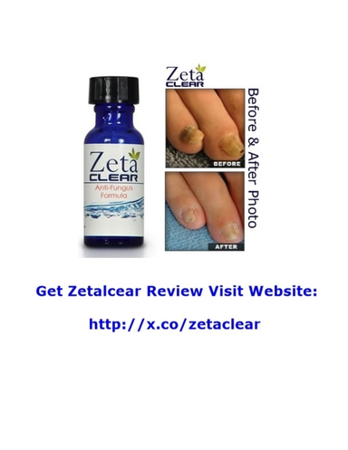 Zetaclear Reviews - Does Zetaclear Really Work ???