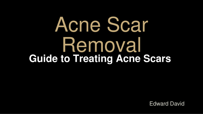 Acne Scar Removal - Guide to Treating Acne Scars