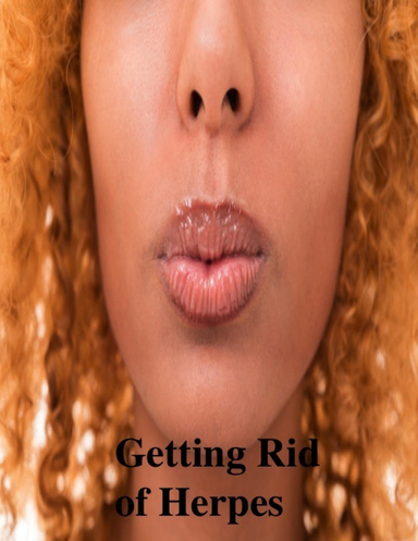 Getting Rid of Herpes