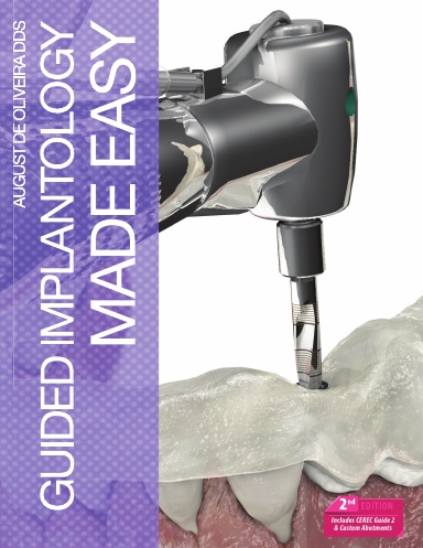 Guided Implantology Made Easy