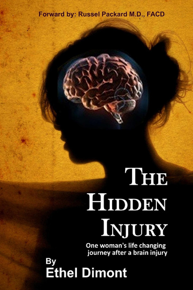 The Hidden Injury