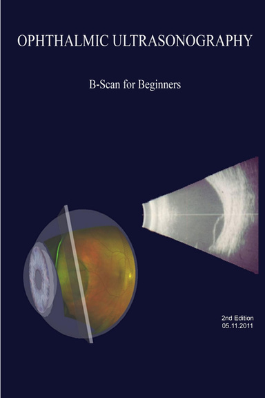 Ophthalmic Ultrasonography: B-Scan for Beginners