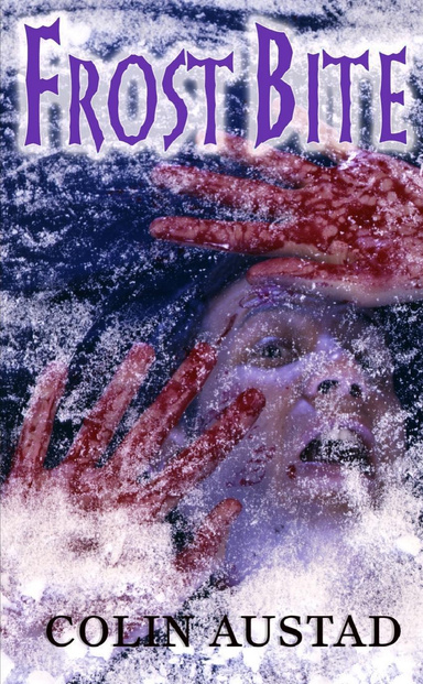 Frost Bite