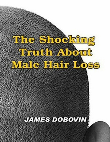 The Shocking Truth About Male Hair Loss