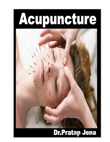 Acupuncture