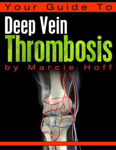 Sleeping Killer - Deep Vein Thrombosis