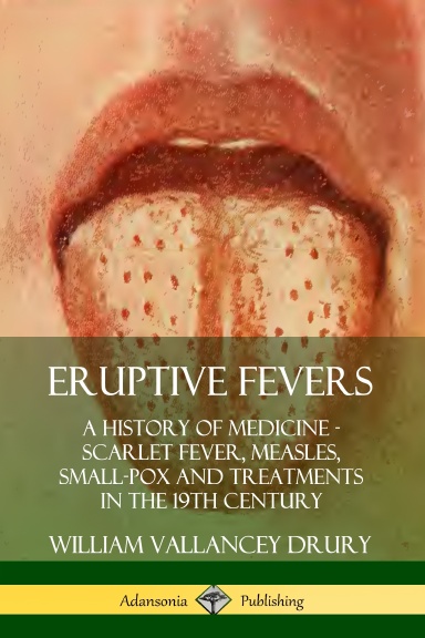 Eruptive Fevers: A History of Medicine - Scarlet Fever, Measles, Small-Pox and Treatments in the 19th Century