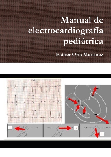 Manual de electrocardiografía pediátrica
