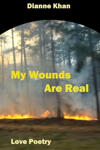 My Wounds are Real