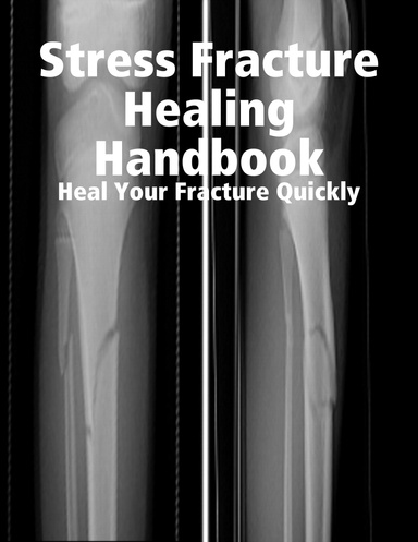 Stress Fracture Healing Handbook