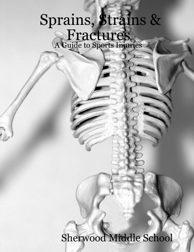 Sprains, Strains & Fractures: A Guide to Sports Injuries