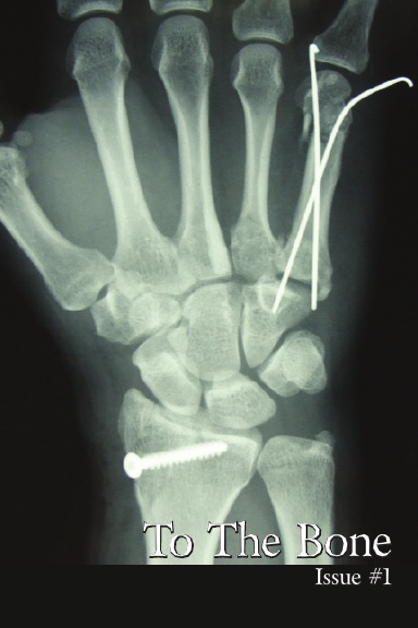 To The Bone #1