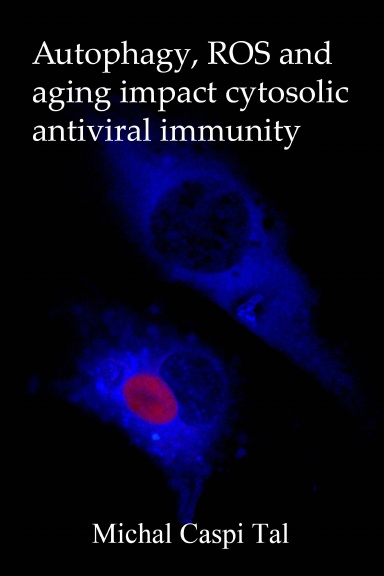 Autophagy, ROS and  aging impact cytosolic antiviral immunity