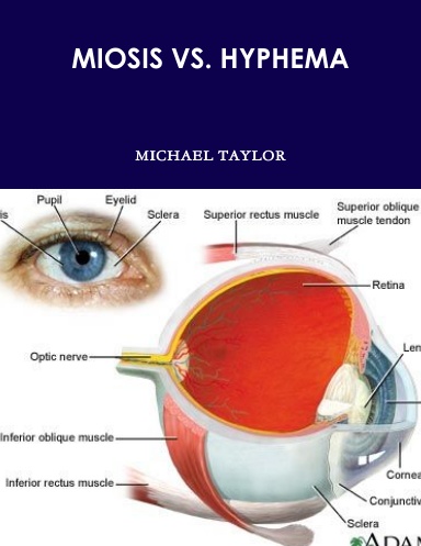 MIOSIS VS. HYPHEMA