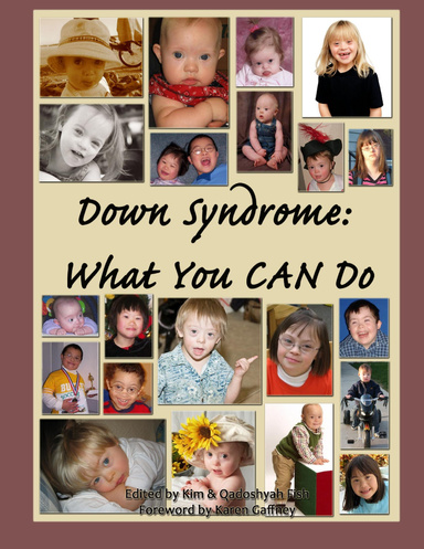 Down Syndrome: What You CAN Do Hardcover
