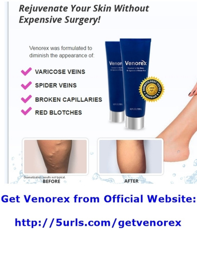 Venorex Reviews - Does Venorex Cream Work ???