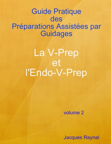 Guide pratique des Préparations Assistées par Guidages La V-Prep et L'Endo-V-Prep  Volume2