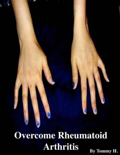 Overcome Rheumatoid Arthritis