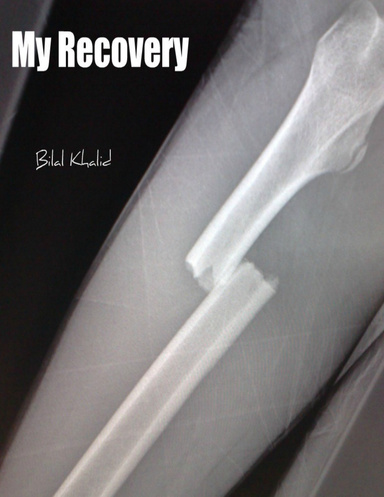 My Recovery