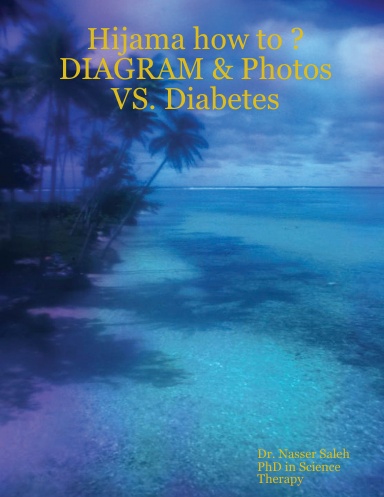 Hijama how to ? DIAGRAM & Photos VS. Diabetes