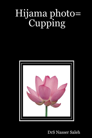 Hijama photo=Cupping