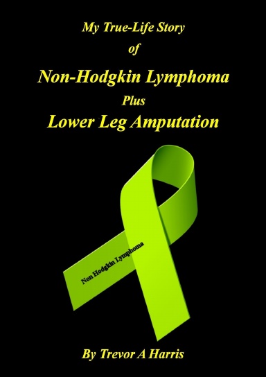 My True-Life Story of Non-Hodgkin Lymphoma plus Amputation