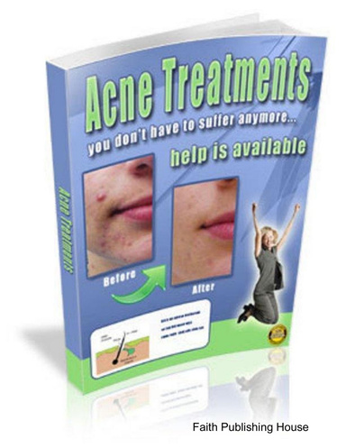 Acne Treatments