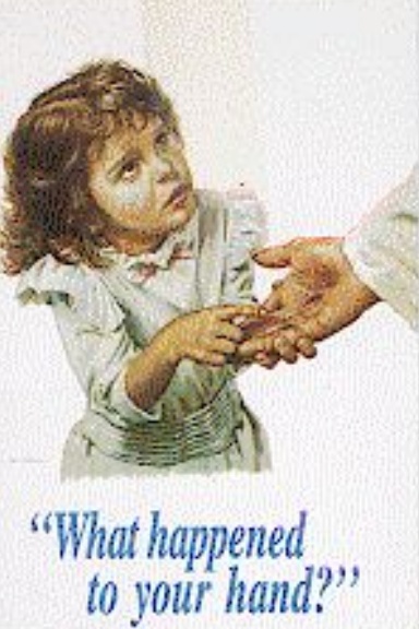 "What Happened to your Hand"