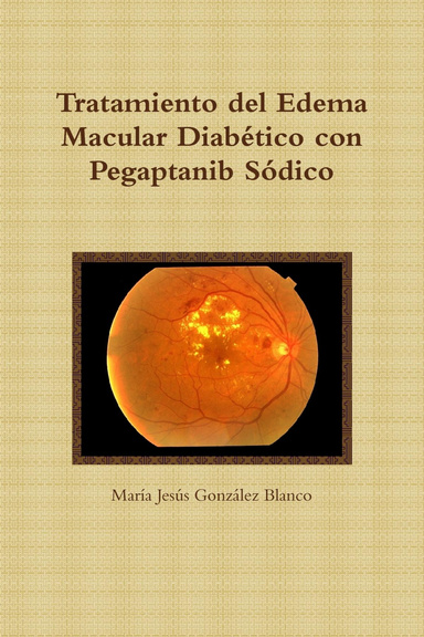 Tratamiento del edema macular diabético con pegaptanib sódico