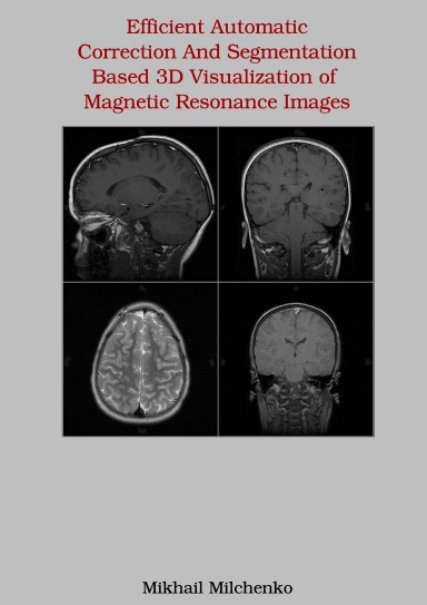 Efficient Automatic Correction And Segmentation Based 3D Visualization of Magnetic Resonance Images