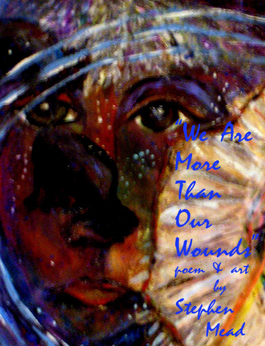 We Are More Than Our Wounds
