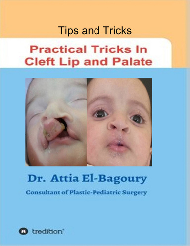 Practical Tricks In Cleft Lip and Palate 2