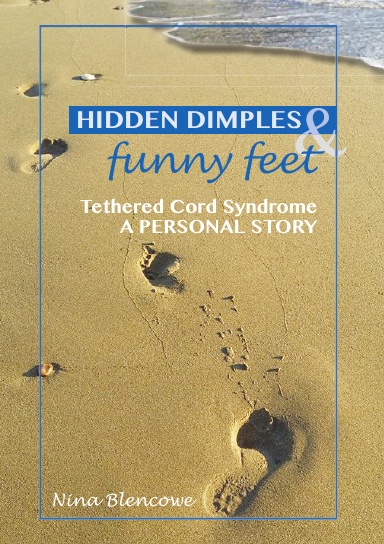 Hidden Dimples and Funny Feet