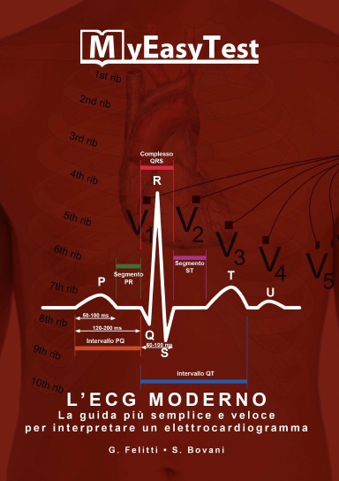 L'ECG Moderno - MyEasyTest (edizione economica)