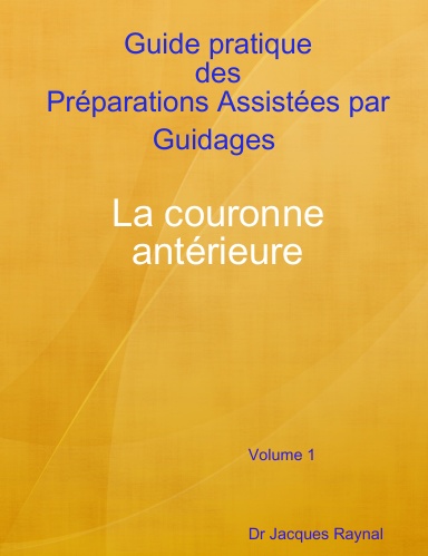 Guide pratique des Préparations Assistées par Guidages La couronne antérieure - Volume 1