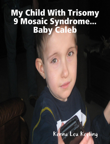 My Child With Trisomy 9 Mosaic Syndrome...Baby Caleb