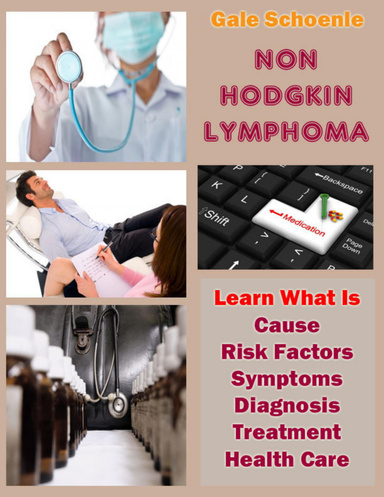 Non-Hodgkin Lymphoma: Learn What Is Cause, Risk Factors, Symptoms ...