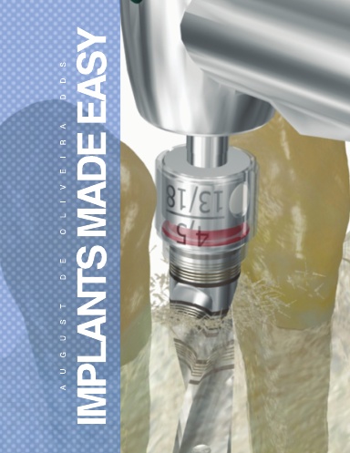 Implants Made Easy