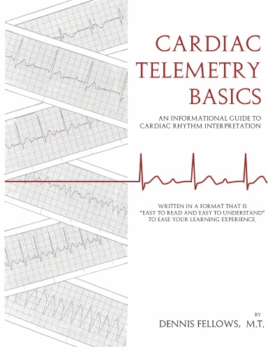 Cardiac Telemetry Basics