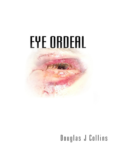 Eye Ordeal