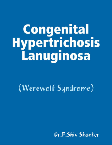 congenital hypertrichosis