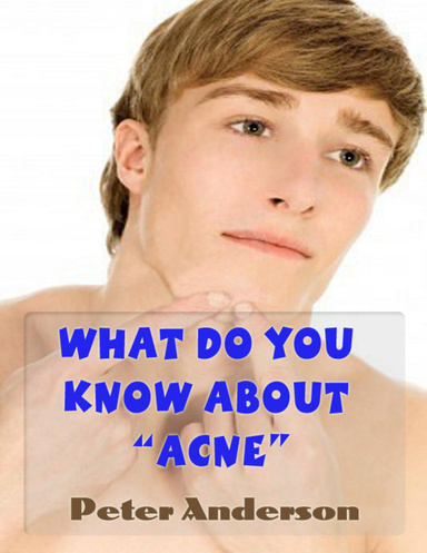 What Do You Know About "Acne"