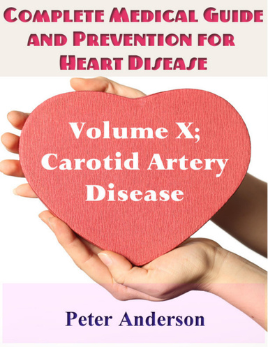 Complete Medical Guide and Prevention for Heart Disease: Volume X; Carotid Artery Disease