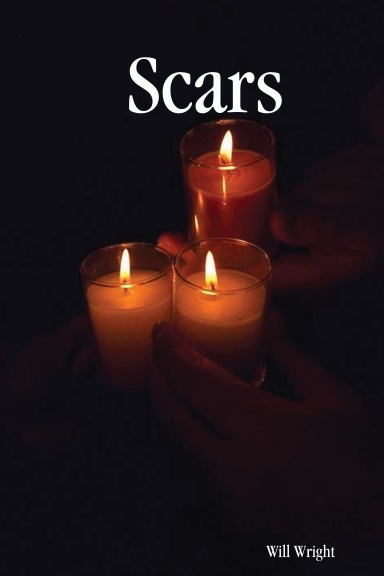 Scars