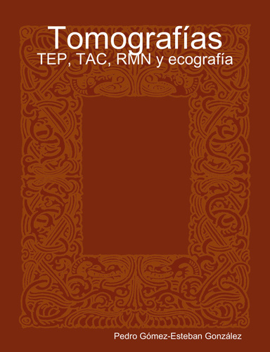 Tomografías - TEP, TAC, RMN y ecografía