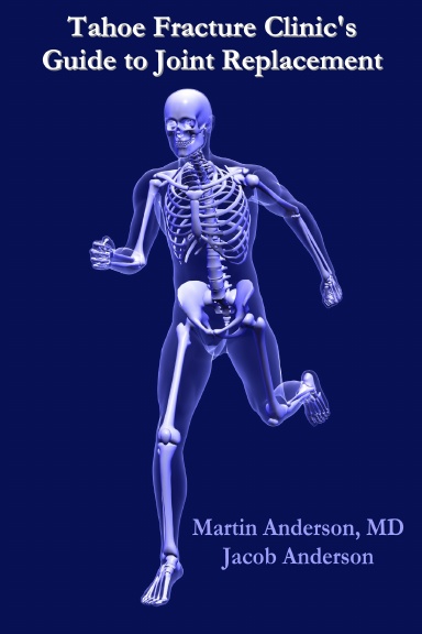 Tahoe Fracture Clinic's Guide to Joint Replacement