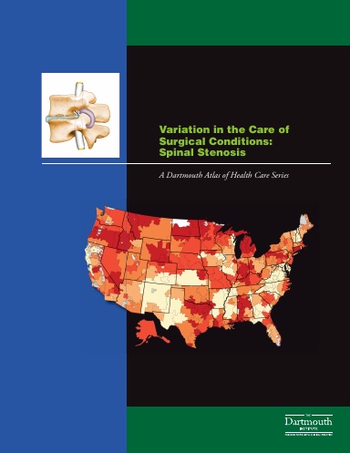 Variation in the Care of Surgical Conditions: Spinal Stenosis