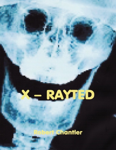 X RAYTED (NEW EDITION)