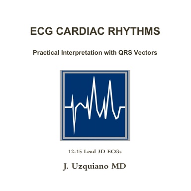 ECG Cardiac Rhythms - Practical Interpretation with QRS Vectors